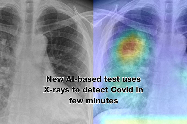 New AI-based test uses X-rays to detect Covid in few minutes