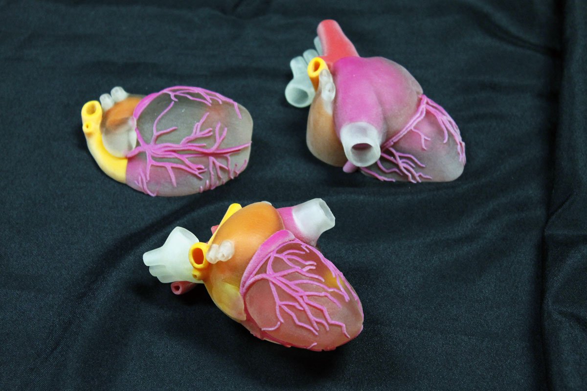 3D Printed Surgical Models Market