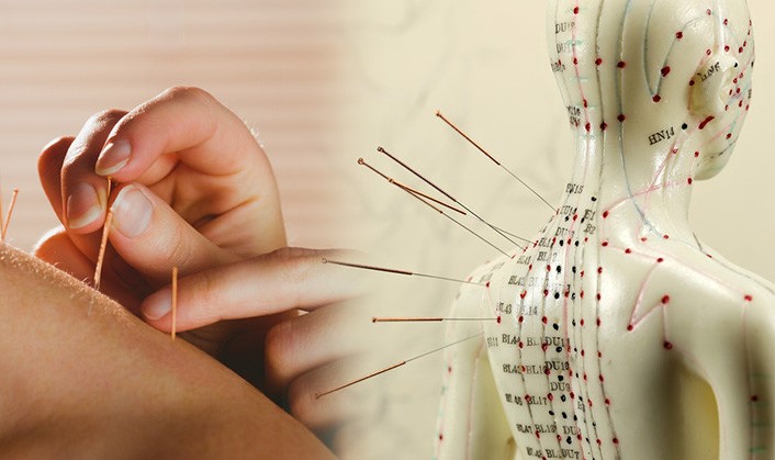 Electric Acupuncture Devices Market