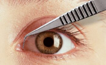 Dry Eye Treatment Devices