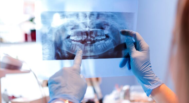 Dental Digital X-ray market